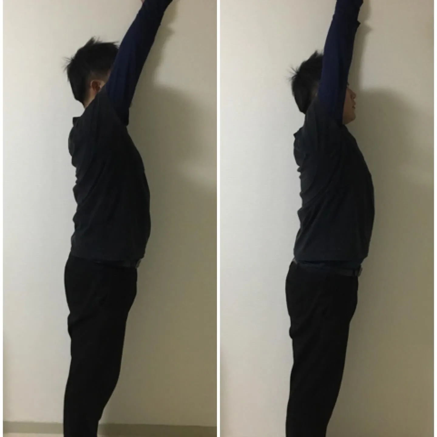 【つらい肩こり…その原因と整体でできる解消法】