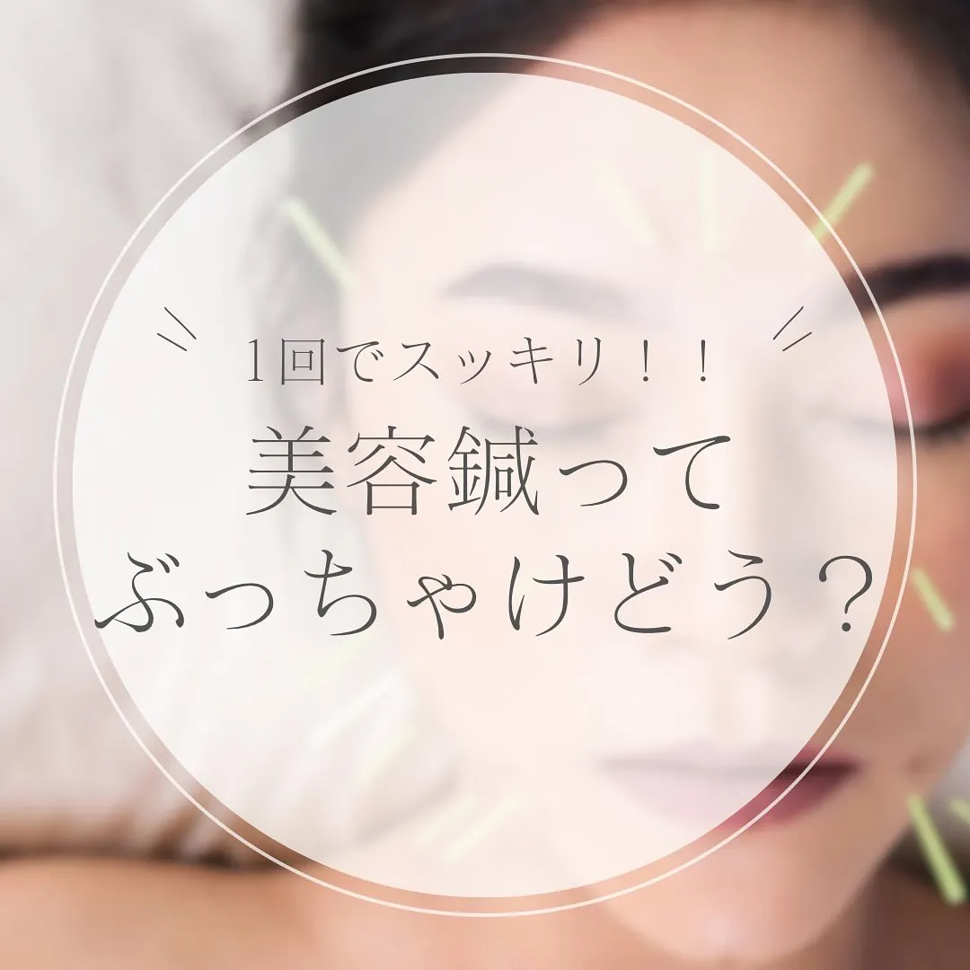 【美容鍼ってぶっちゃけどう？】1回でも効果あり