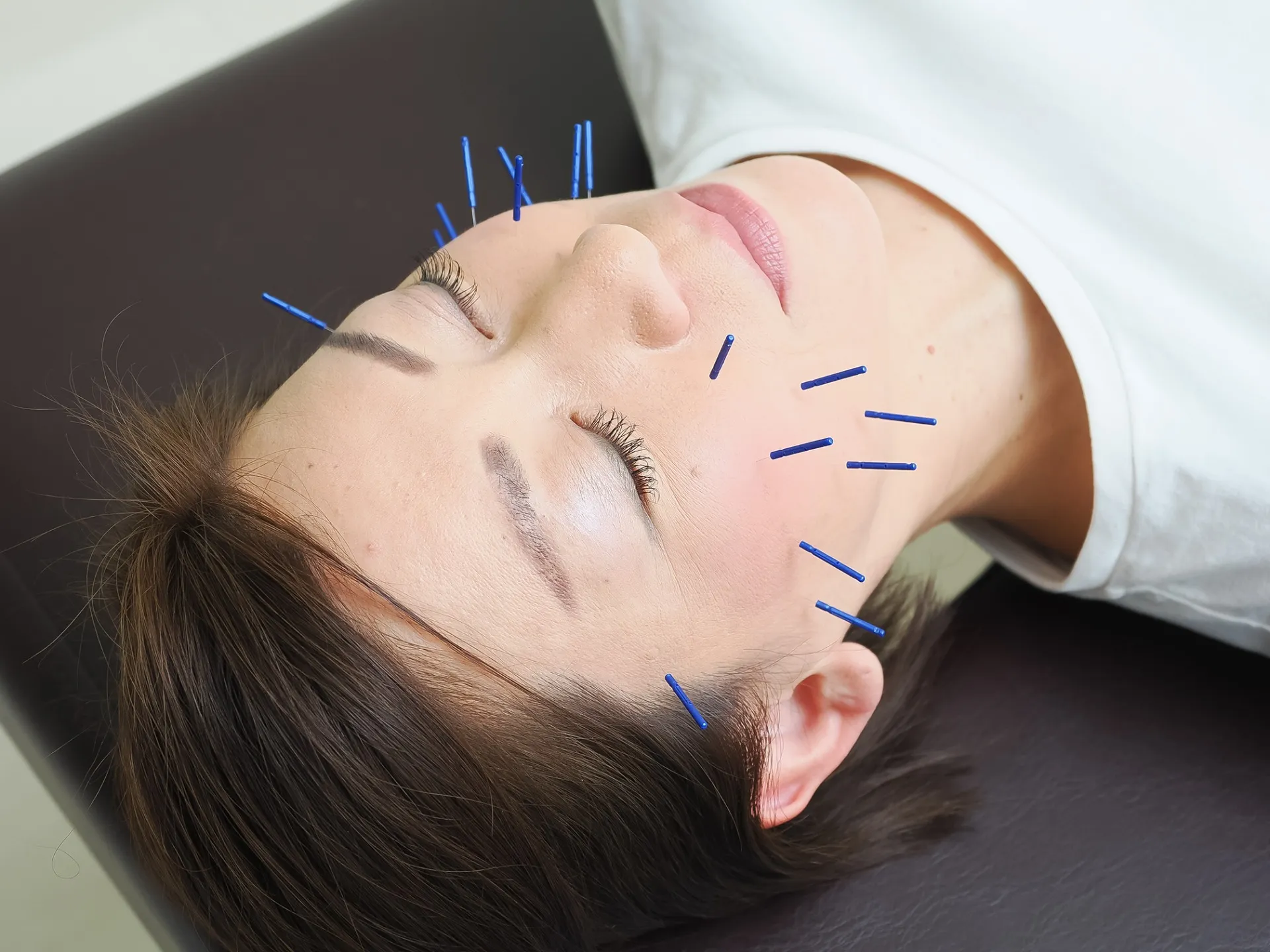 トータルトリートメント優鍼灸院