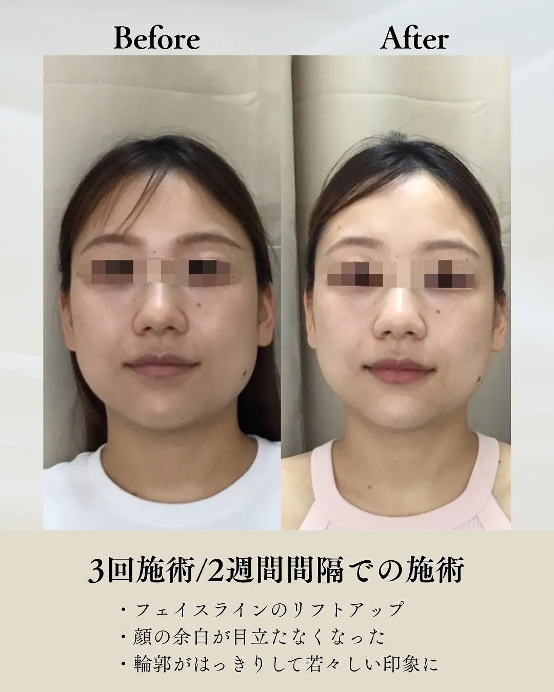 クリスマス前に！お肌リセット＆潤いケアキャンペーン🎄