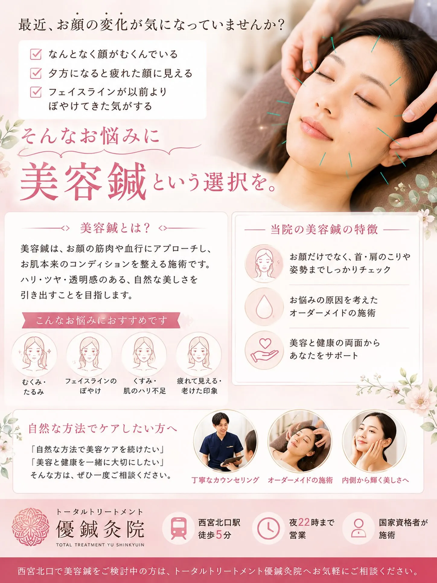 【朝、鏡を見るのが楽しみになる美容鍼】